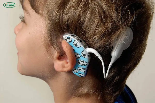 battery affect the performance of a cochlear implant